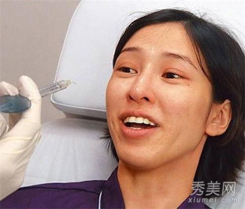 明星整容打針,揭秘整容打針背后的真相與風(fēng)險