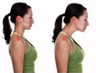 猥瑣頸女明星,猥瑣頸女明星的成名之路與爭議瞬間