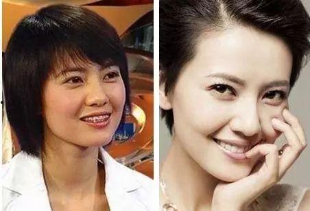 明星都是在哪整的容,探尋明星美容秘密基地